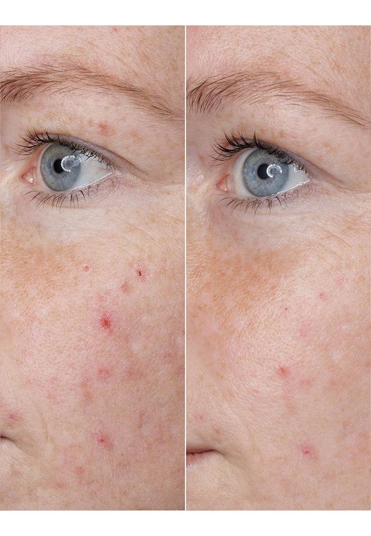 BABOR BABOR HYALURONIC ACID AMPOULE - Serum Cyber Monday