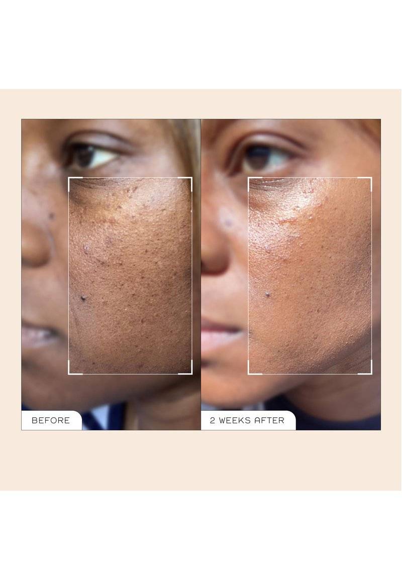 REN CLEAN SKINCARE REN CLEAN SKINCARE READY STEADY GLOW DAILY AHA TONIC - Toner Vierteljährliche Förderung