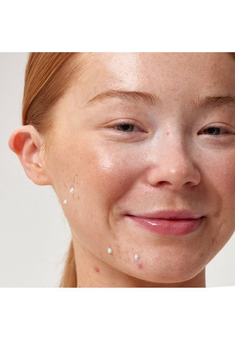 The INKEY List The INKEY List SUCCINIC ACID BLEMISH TREATMENT - Face cream - transparent Vierteljährliche Förderung