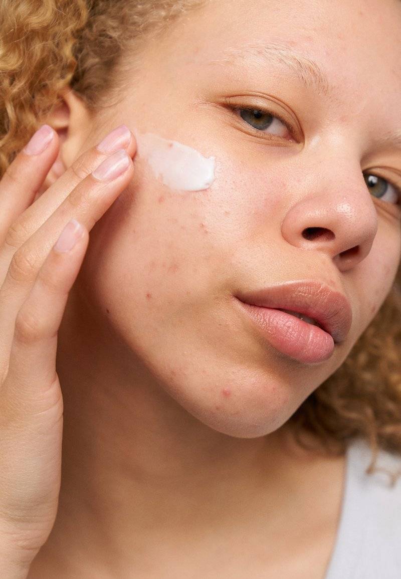 Revolution Skincare Revolution Skincare CERAMIDES MOISTURE LOTION - Face cream Begrenztes Angebot